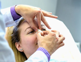 opération nasale à Lyon